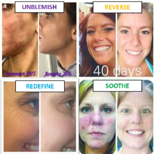 , Rodan + Fields Consultant 