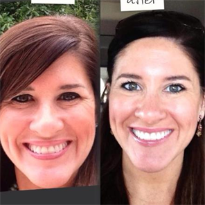 , Rodan + Fields 