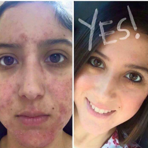, Rodan and Fields 