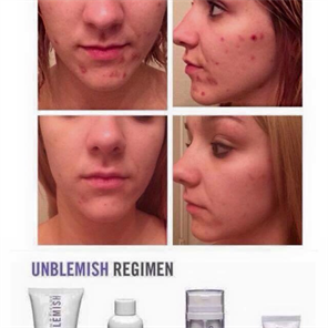 , Rodan and Fields Skincare 
